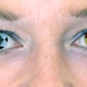 Illustration for article titled Color Contact Lenses Could Cause Cornea Ulcers, Other Horrors